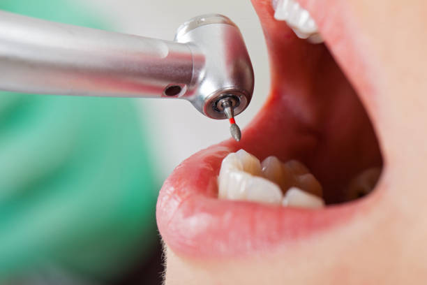 Best Emergency Dental Care for Sports Injuries in New Cordell, OK